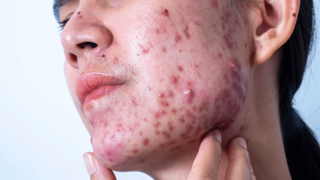 Skin clinic by Dr Raza & Dr Arooj - Aesthetic clinic in Faisalabad