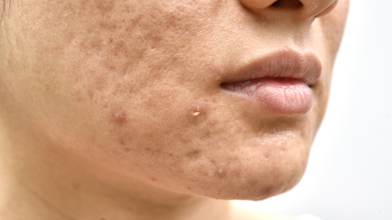 Skin Clinic by Dr Raza & Dr Arooj - Aesthetic clinic in Faisalabad